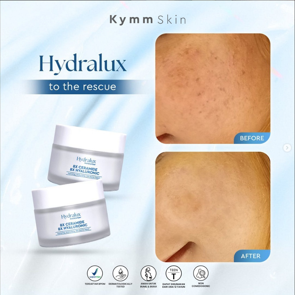Jual KYMM SKIN Hydralux Moisturizer 8X Ceramide 8X Hyaluronic | Shopee ...