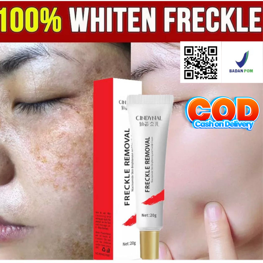 Jual Cream flek hitam bintik hitam di wajah melasma membandel