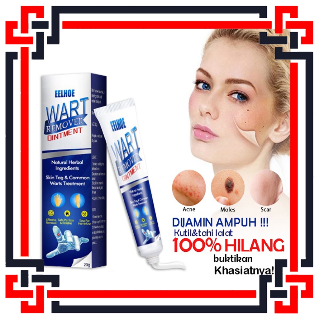 Jual LS Wart Remover Penghilang Flek Hitam Skin Tag Penghilang Kutil ...