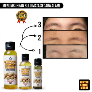 Jual Minyak Kemiri Gold Dan Kemiri Bakar 100% Asli - Minyak Penumbuh ...