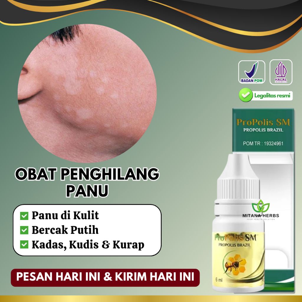 Jual Obat Pengilang Panu, Obat Panu Cair, Obat Jamur Kulit, Obat Panu