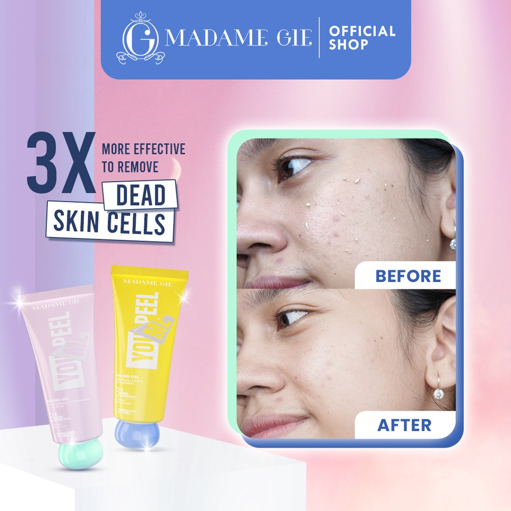 Jual MADAME GIE You Peel Me Peeling Gel Cleanser 100ml Shopee Indonesia