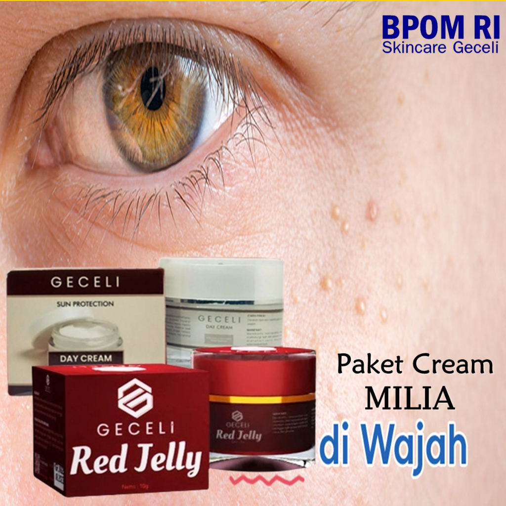 Jual PAKET 2 IN 1 Ampuh Krim Penghilang Milia di bawah mata Cream