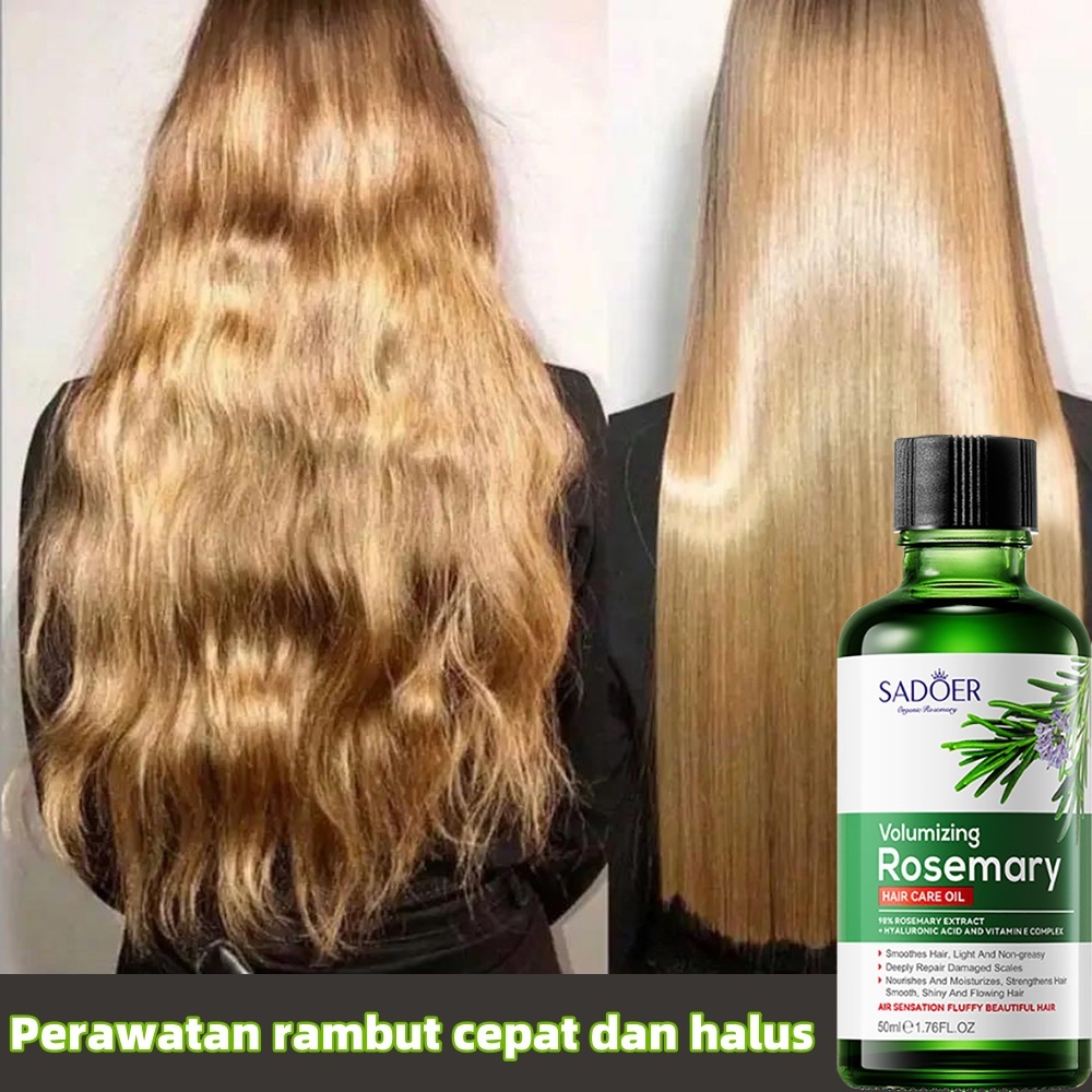 Jual Rosemary Oil Obat Penumbuh Rambut Botak Tipis dan Rontok Super ...