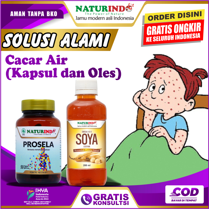 Jual OBAT CACAR AIR ANAK DEWASA PENGHILANG BEKAS CACAR API KULIT BINTIK ...