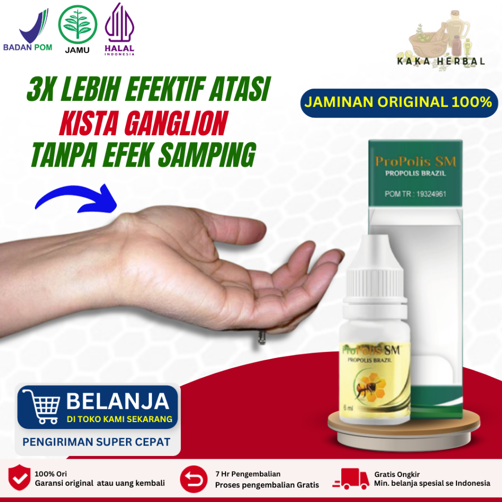 Jual Kaka Herbal - Obat Penghancur Kista Ganglion, Obat Kista Ganglion ...