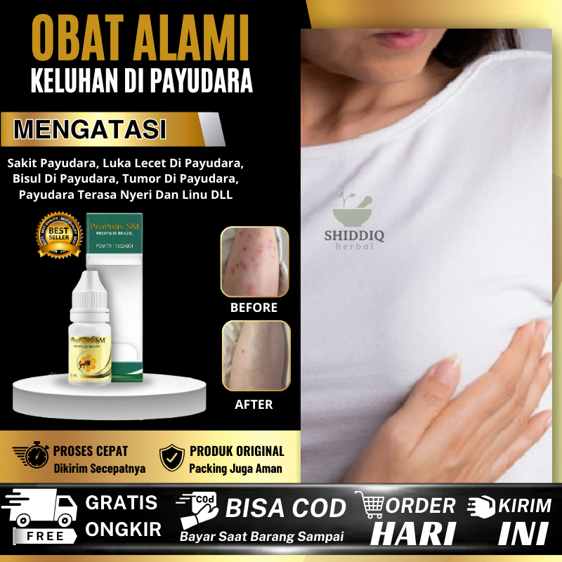 Jual Spesialis Obat Luka Di Payudara Obat Borok Bernanah Parah Di