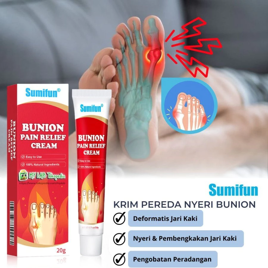 SUMIFUN Salep Cream Bunion Meredakan Nyeri Sendi Asam Urat | AutoStock