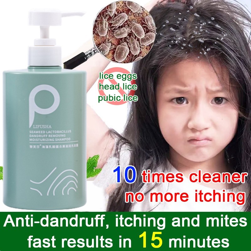 Jual Obat Ketombe Shampoo Anti Ketombe Dan Rontok Anti Dandruff Shampoo