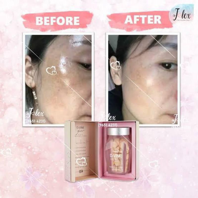 Jual D Vine Collagen Isi 30 butir Original Candy DVINE Collagen