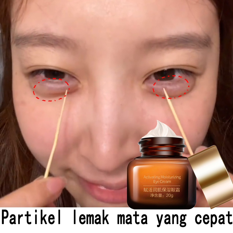 Jual Eye cream menghilangkan milia menghilangkan keriput di mata dan