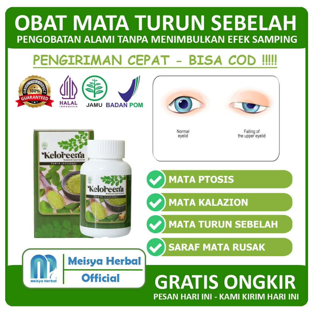 Jual Obat Kelopak Mata Turun Sebelah Beda Sebelah Mata Ptosis Saraf