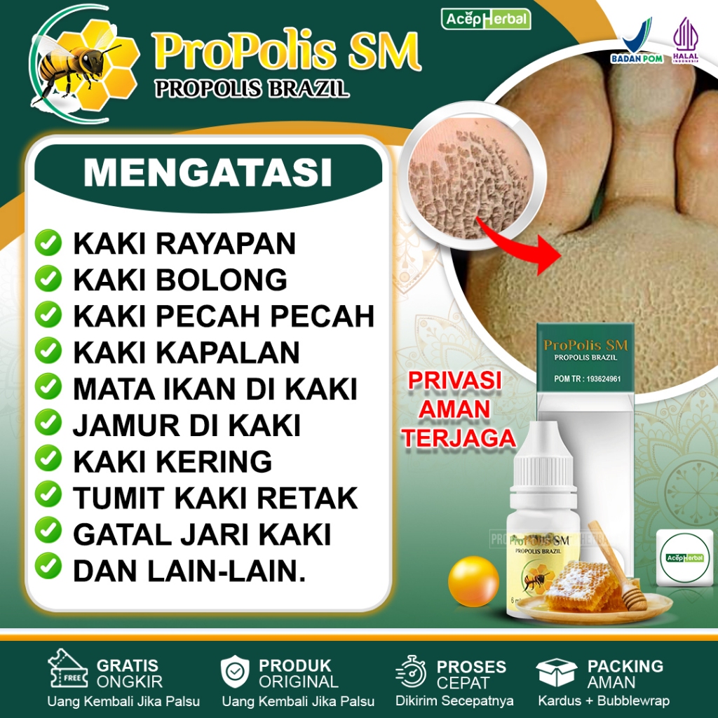 Jual Obat Kaki Rayapan Telapak Kaki Bolong Bolong Kaki Pecah Pecah Kaki ...