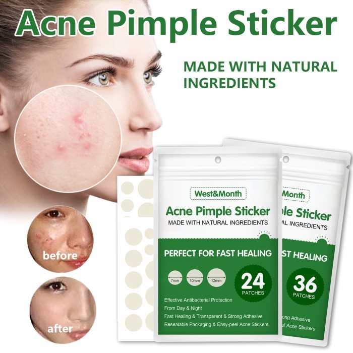 Jual West & Month Acne Pimple Patch Sticker - Tambalan Jerawat Tak ...
