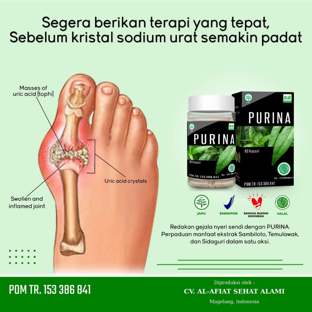 Purina - Obat Herbal Asam Urat dan Nyeri Sendi