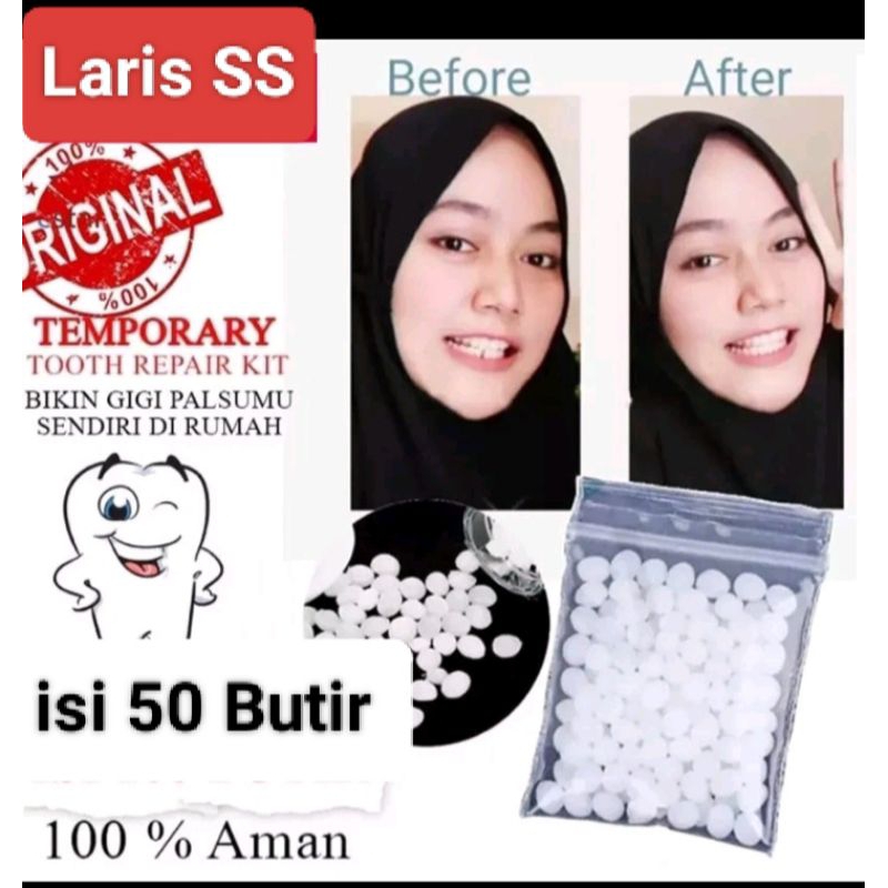 Jual Penambal Gigi Isi 50 Butir Shopee Indonesia 8119