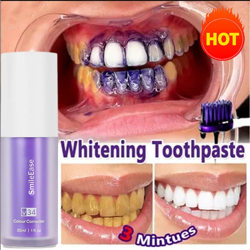 Jual Esensi Botol Ungu Kecil Pasta Gigi Teeth Whitening Kit HiSmile