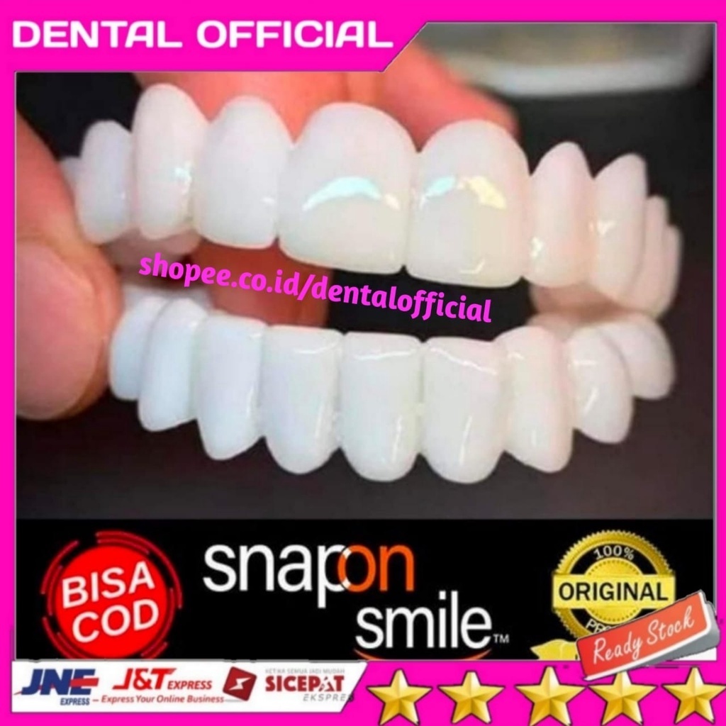 Jual Gigi Palsu Snap On Smile ORIGINAL Authentic 1 Set ORI dan VIRAL ...