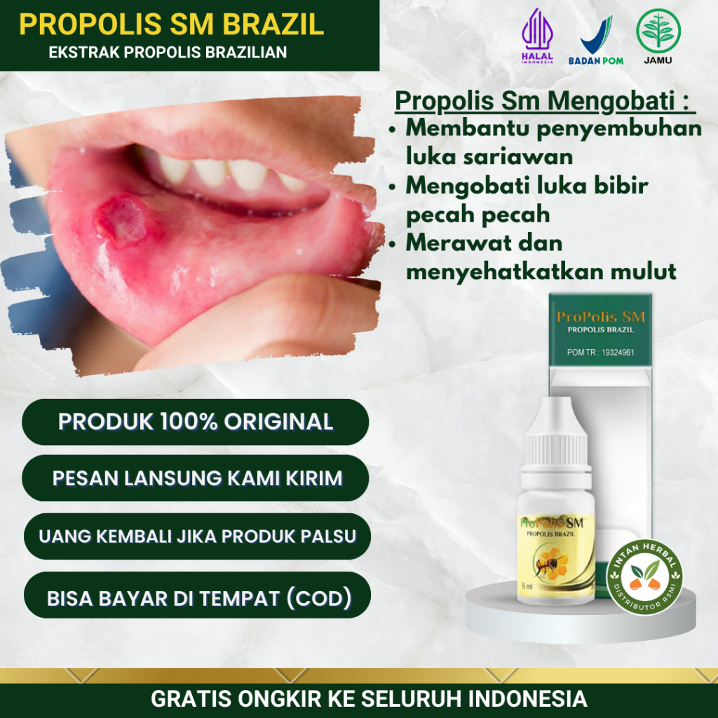 Jual Propolis Sm 6ml Obat Tetes Sariawan Di Bibir Sariawan Menahun