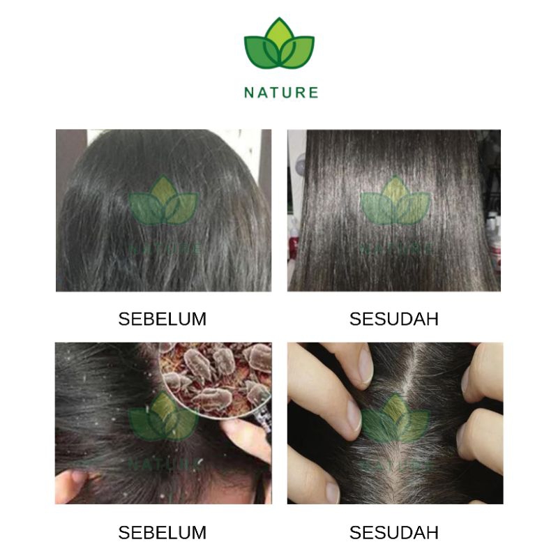 Jual Nature Minyak Kelapa Murni VCO Virgin Coconut Oil 100% Asli ...