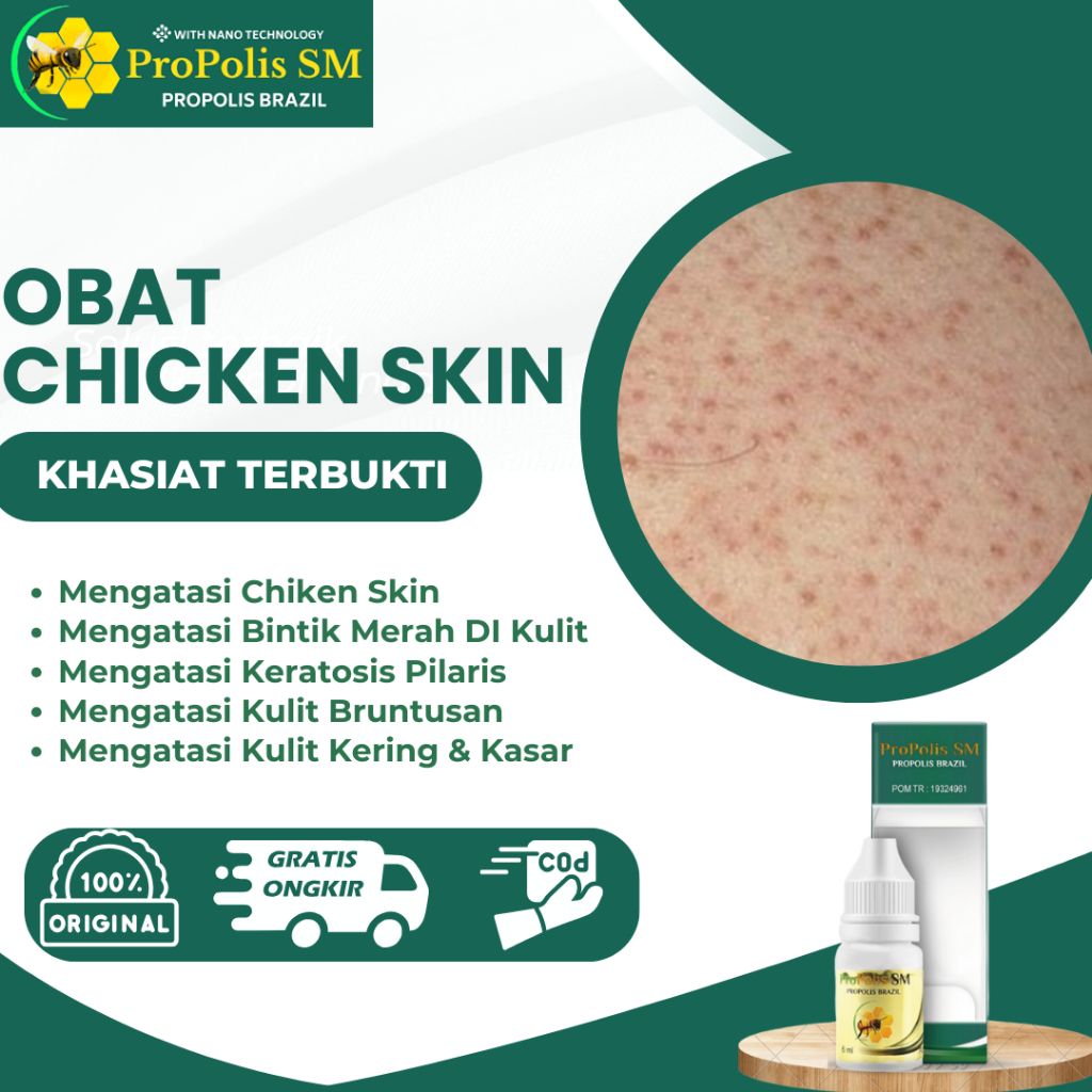 Skincare Penghilang Chicken Skin