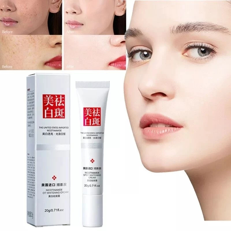 Jual Fuyan Whitening Freckle Cream Remove Dark Spots Anti Freckle Krim Penghilang Flek Hitam 1087