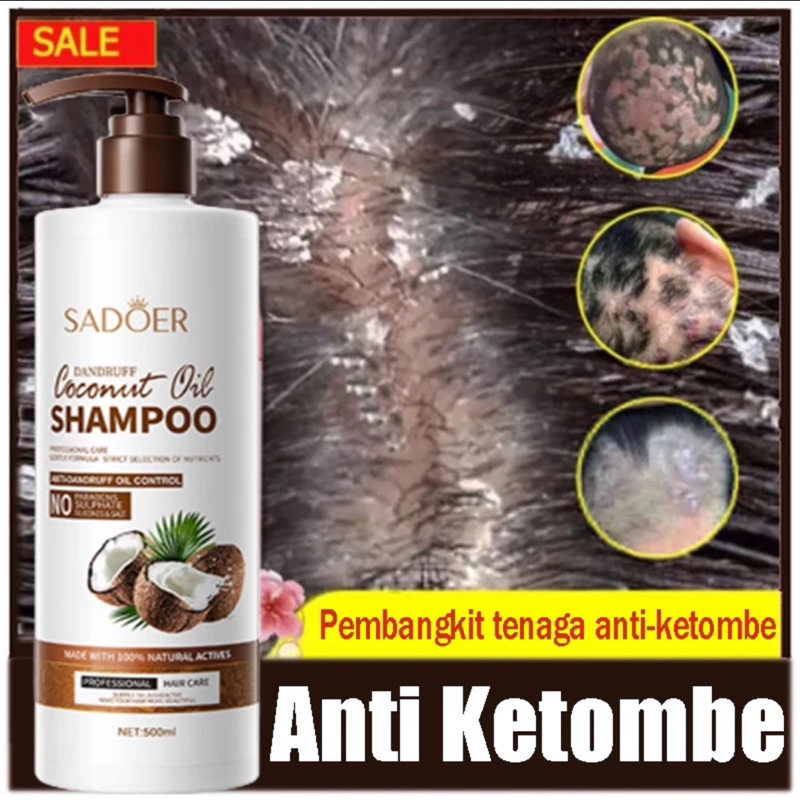 Jual SAMPO ANTI KETOMBE PALING AMPUH HILANGKAN KETOMBE SAMPO minyak