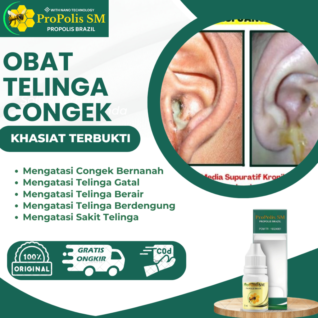 Jual Obat Congek Bernanah Telinga Gatal Berair Berdengung Curek Sakit ...