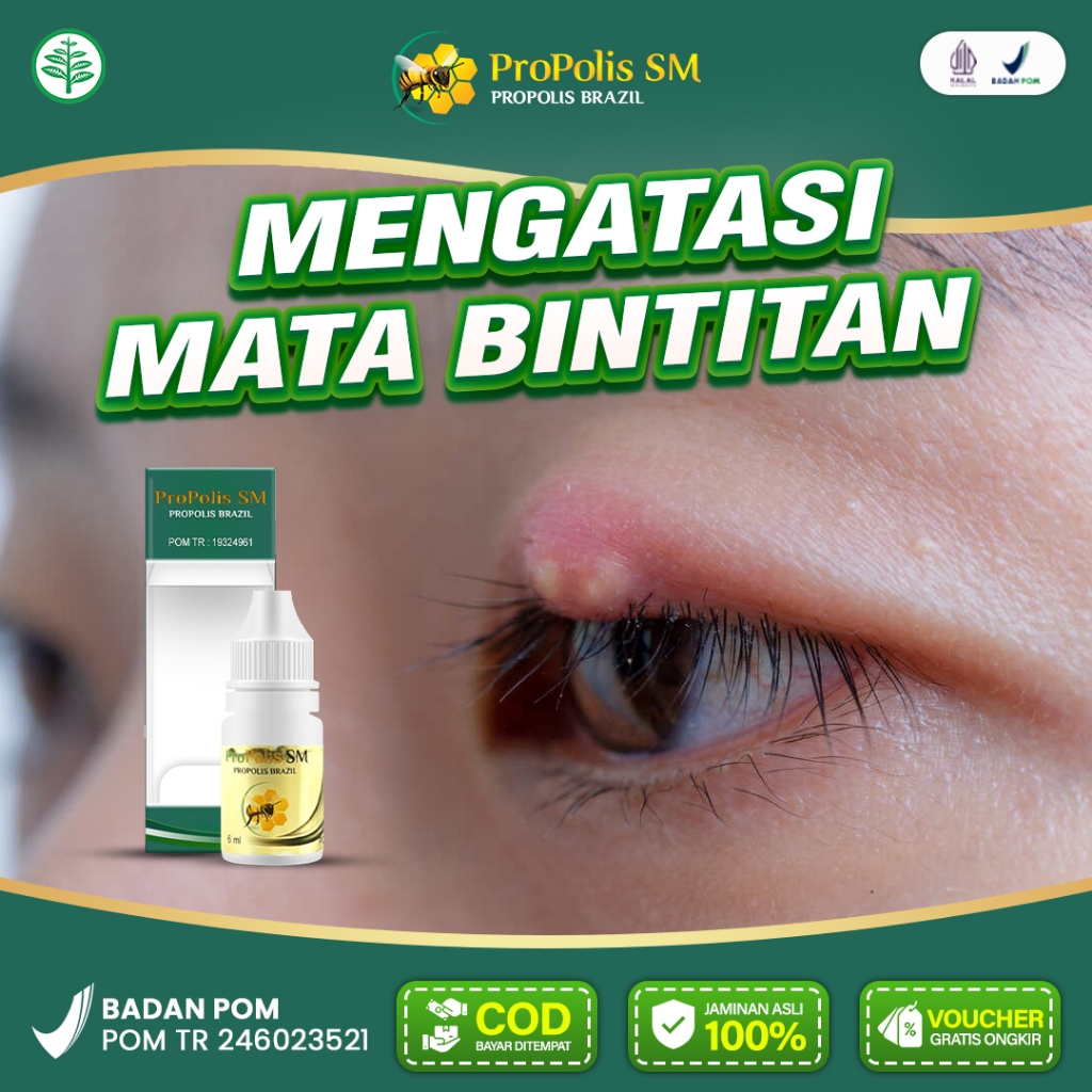 Jual Propolis SM Obat Mata Bintitan Bintilan Kalazion Benjolan Di Mata ...