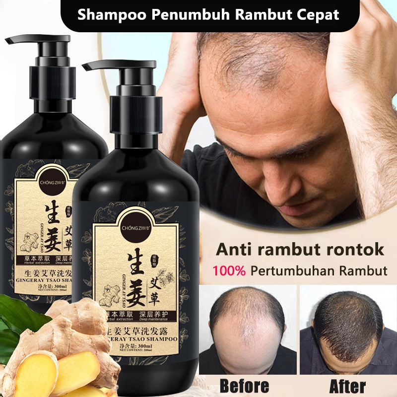 Jual Shampo Jahe Penumbuh Rambut Cepat Anti Rambut Rontok Shampo 300ML ...