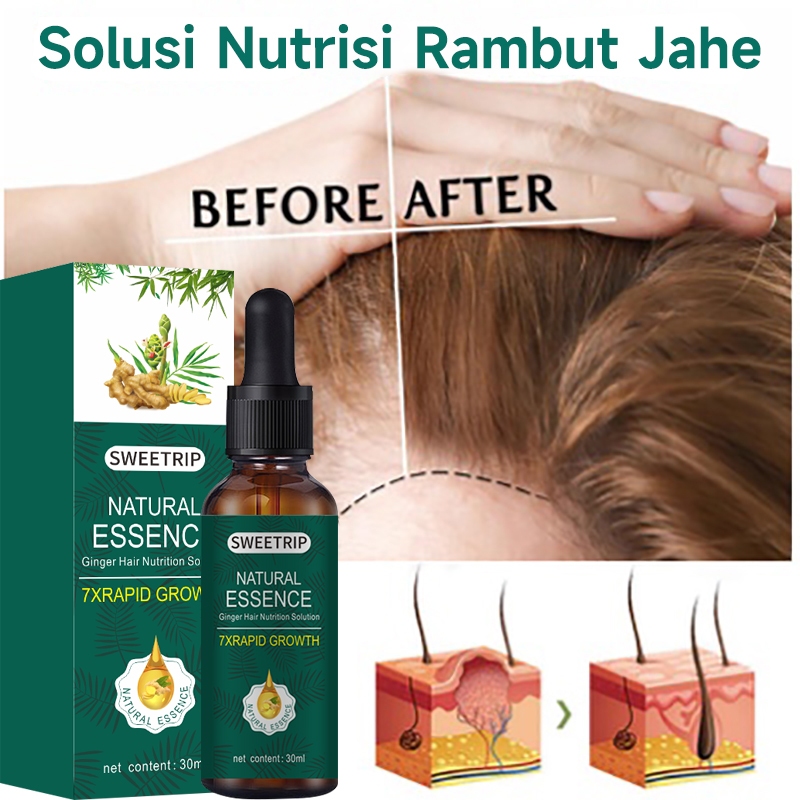 Jual Natural Beard Oil Serum Hair Growth Oil Penumbuh Dan Penebal ...