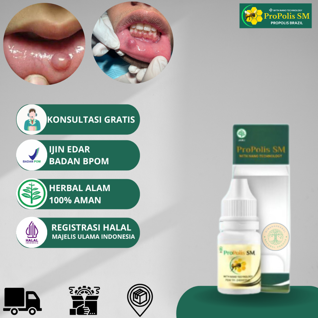 Jual Obat Benjolan di Bibir, Obat Benjolan Di Lidah, Benjolan Di Mulut
