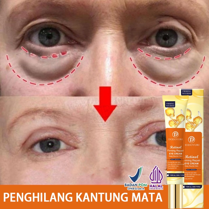 Jual Eye cream mata panda menghilangkan mata panda penghilang kantung