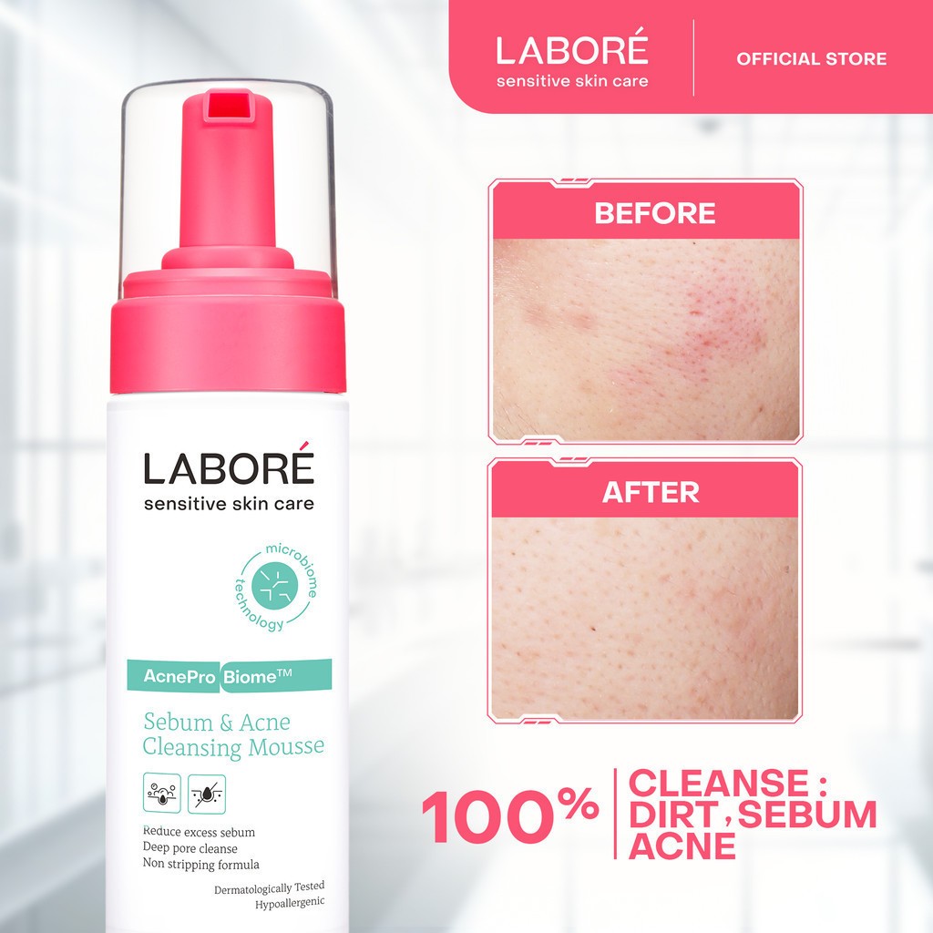 Jual LABORE AcnePro Biome Sebum & Acne Cleansing Mousse | Shopee Indonesia