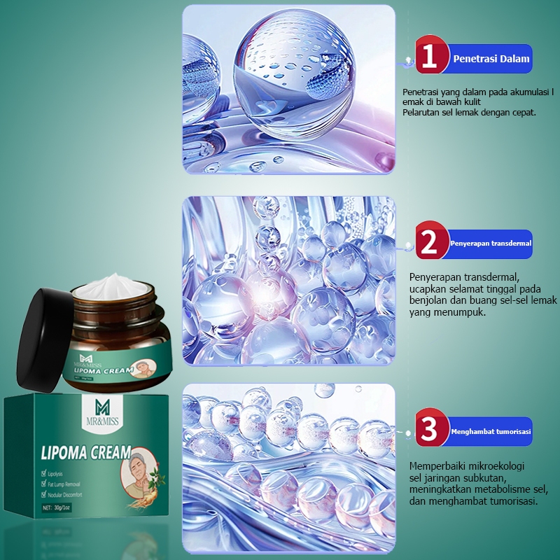 Jual AMND Lipoma cream original Obat benjolan Lipoma removal cream ...