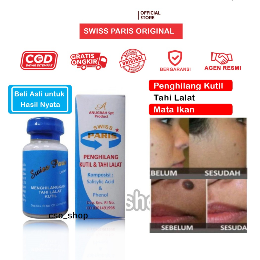 Jual Swiss Paris Lotion Original Obat Penghilang Tahi Lalat, Kutil