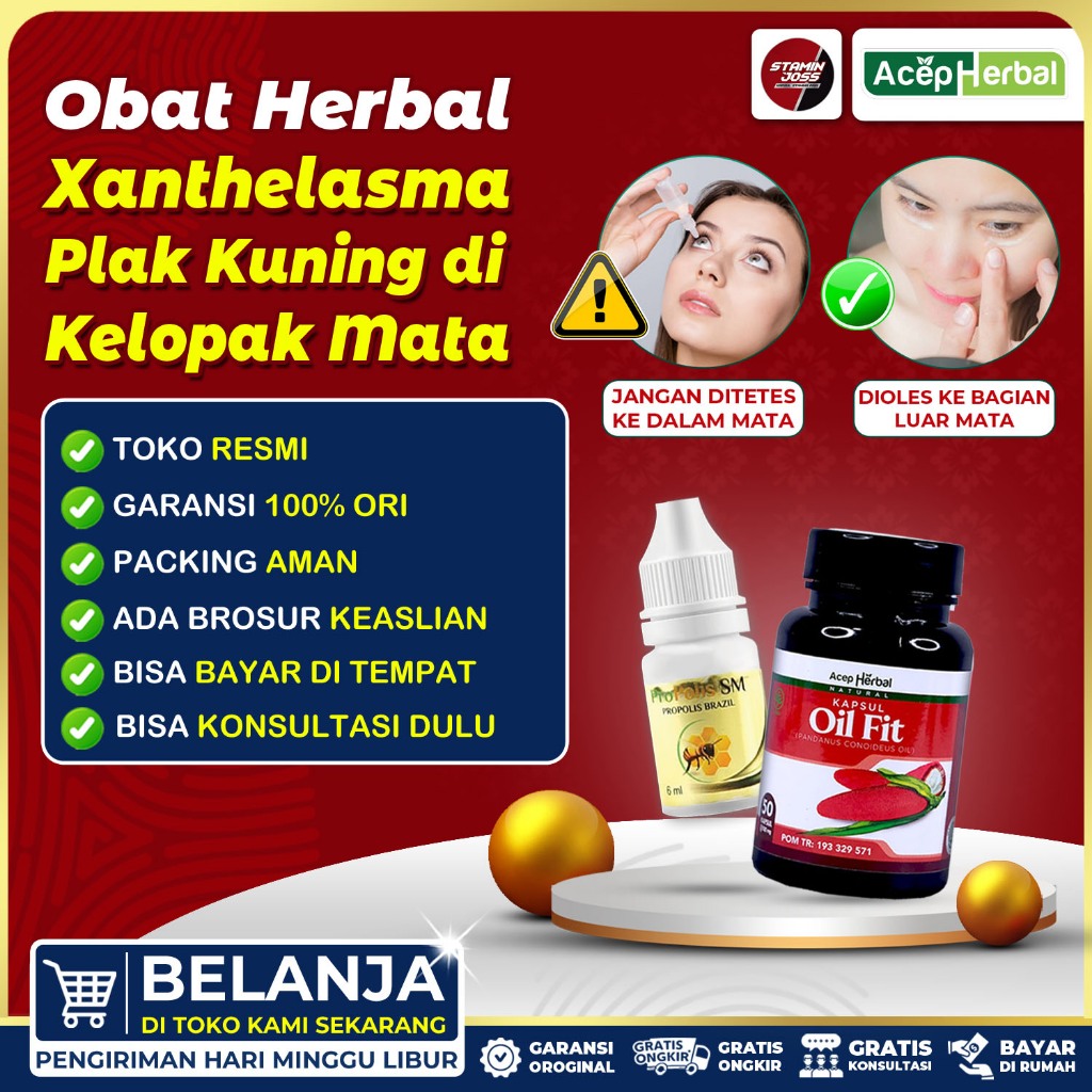 Jual Obat Xanthelasma Obat Penghilang Gumpalan lemak Di Kelopak Mata