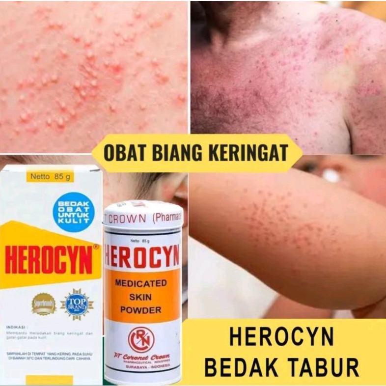 Jual HEROCYN KALENG Medicated Powder bedak Obat Gatal Badan gatal ...