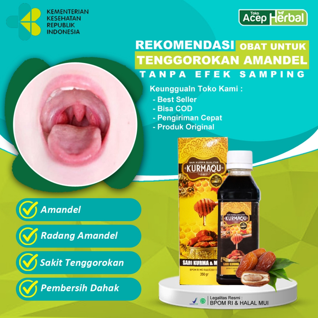 Jual Obat Sakit Amandel Bau Mulut Radang Tenggorokan Radang Amandel