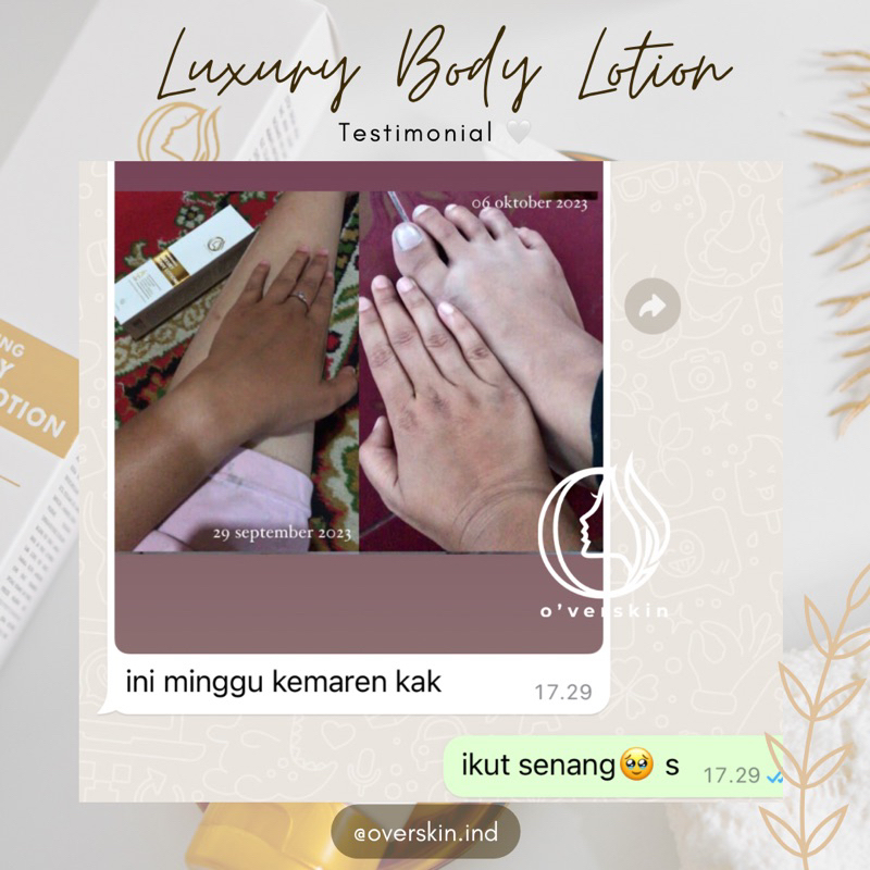 Jual WHITENING LUXURY BODY LOTION OVERSKIN BPOM, Lotion Whitening aman untuk bumil busui