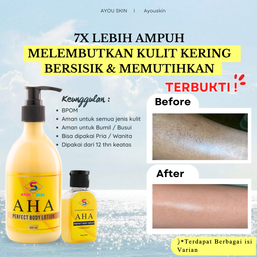 Jual Handbody Untuk Kulit Tangan Kaki Kering, Krim Buat Kulit Tangan