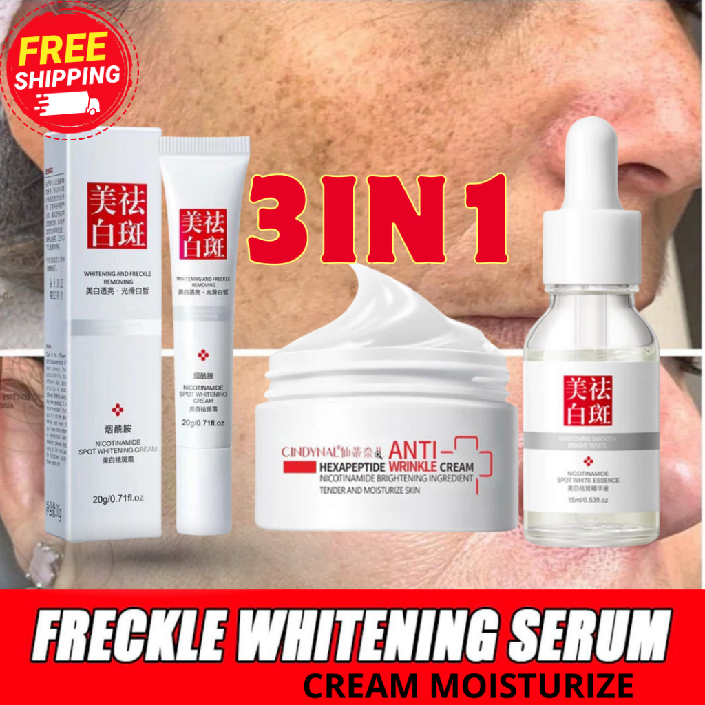 Jual Cream flek hitam bintik hitam di wajah melasma membandel