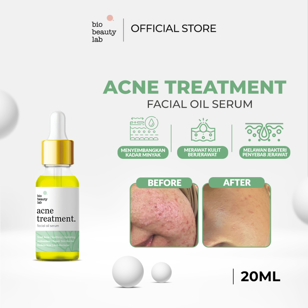 Jual Bio Beauty Lab 20ml Acne treatment ( HEALING ) Facial Oil Serum