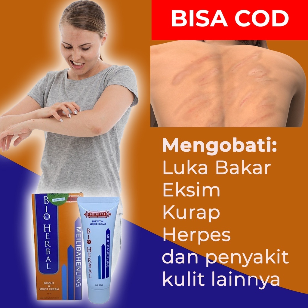 Jual Obat Cream Krim Salep Penghilang Mengobati Luka Kulit Lama Cacar Bekas Jerawat Flek Hitam