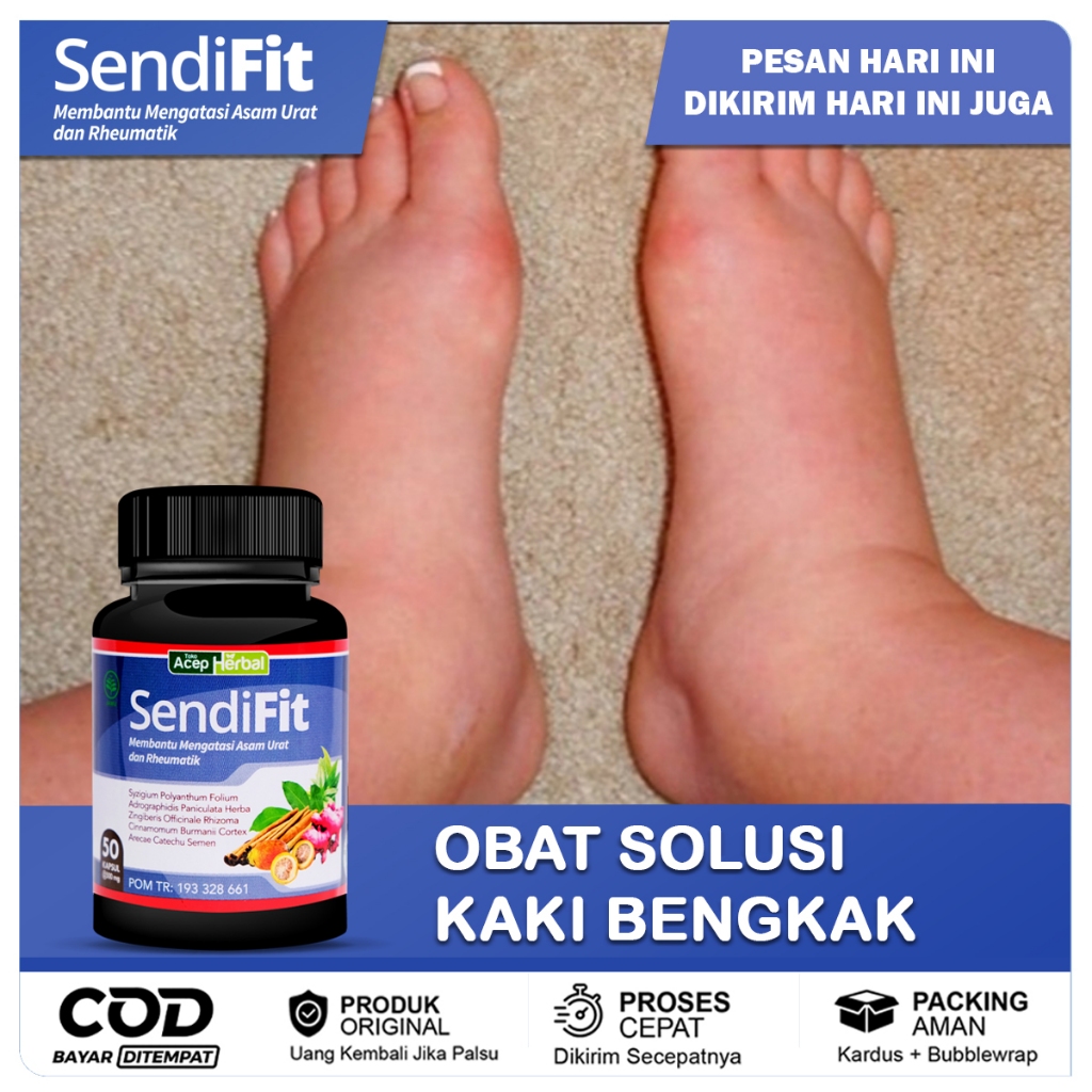 Jual Obat Kaki Bengkak Linu Susah Bergerak Kaki Bengkak Keseleo Asam ...