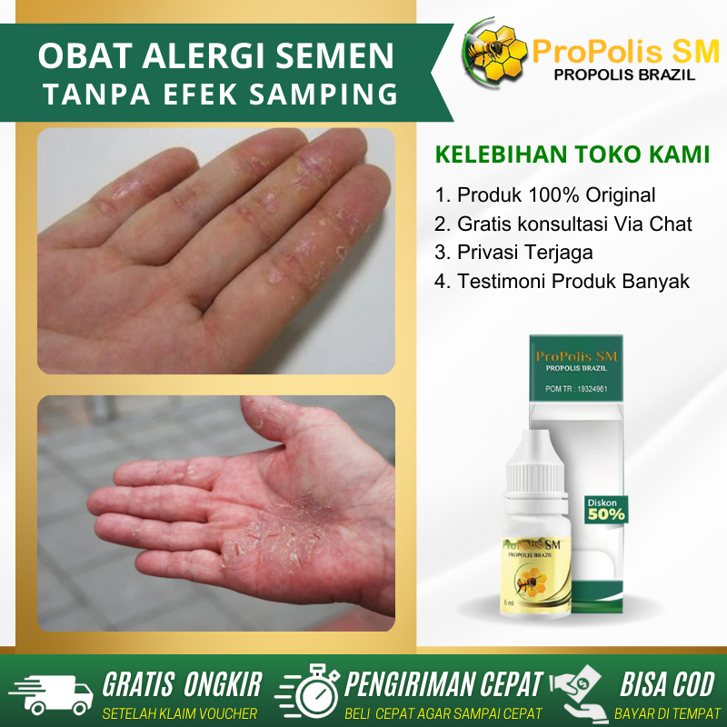 Jual Obat Alergi Semen Kulit Tangan Mengelupas Obat Tetes Pengering