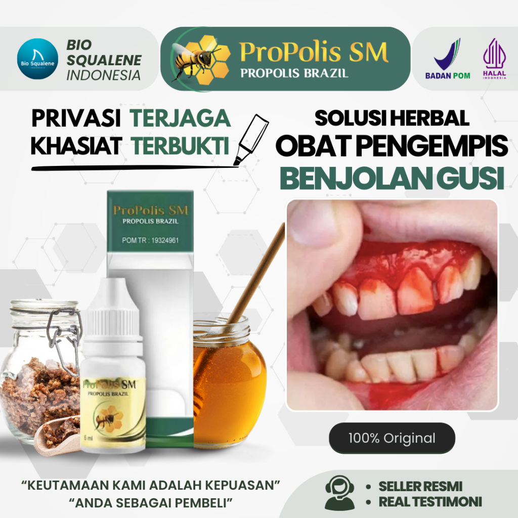 Jual Obat Tetes Kumur Pengempis Gusi Bengkak Akibat Sariawan Akut