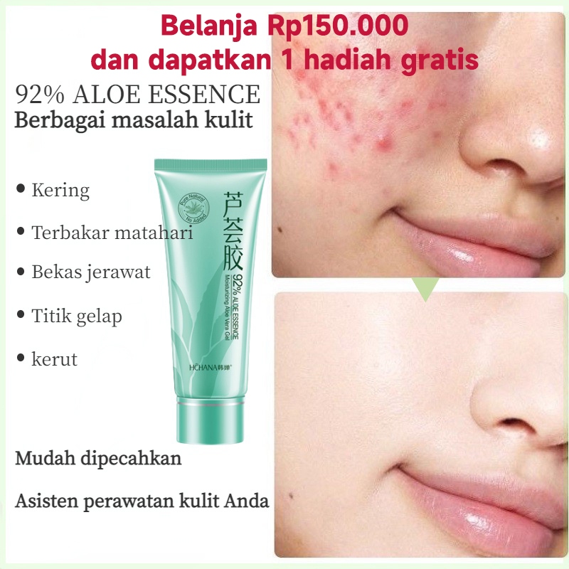 Jual Sabun jerawat punggung ance Body wash whitening sabun jerawat
