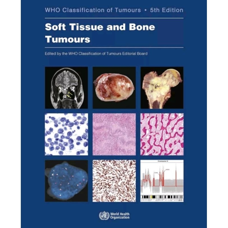 Jual [Full Color /BW] WHO Classification of Tumours of Soft Tissue and ...