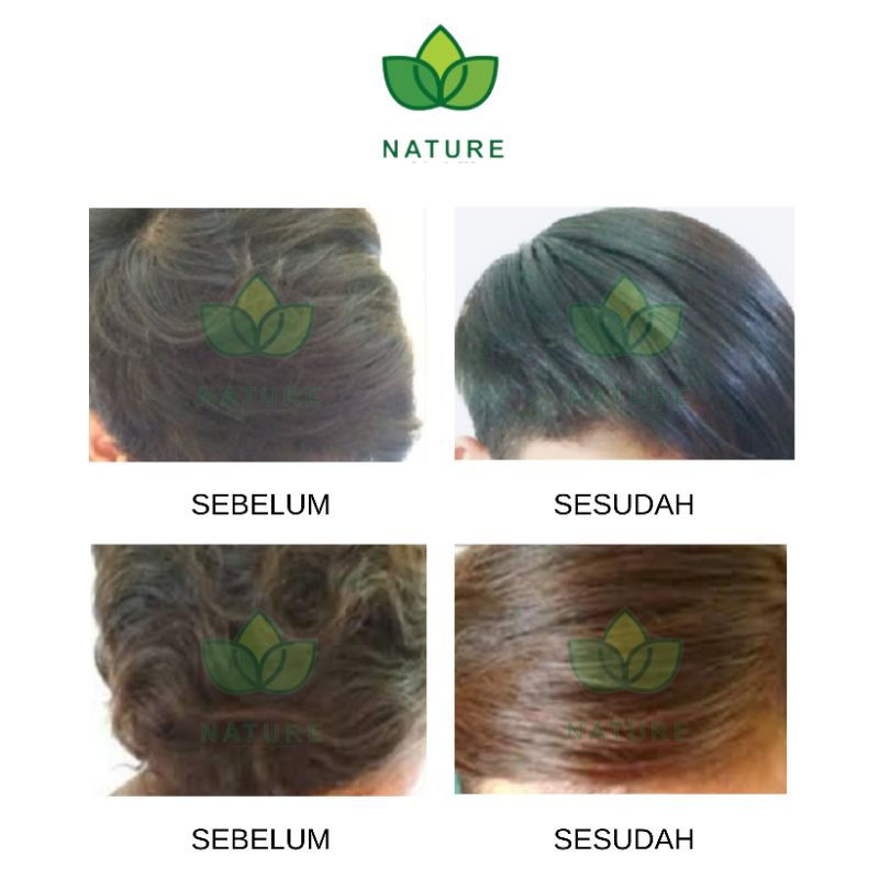 Jual Nature Minyak Kelapa Murni VCO Virgin Coconut Oil 100% Asli ...